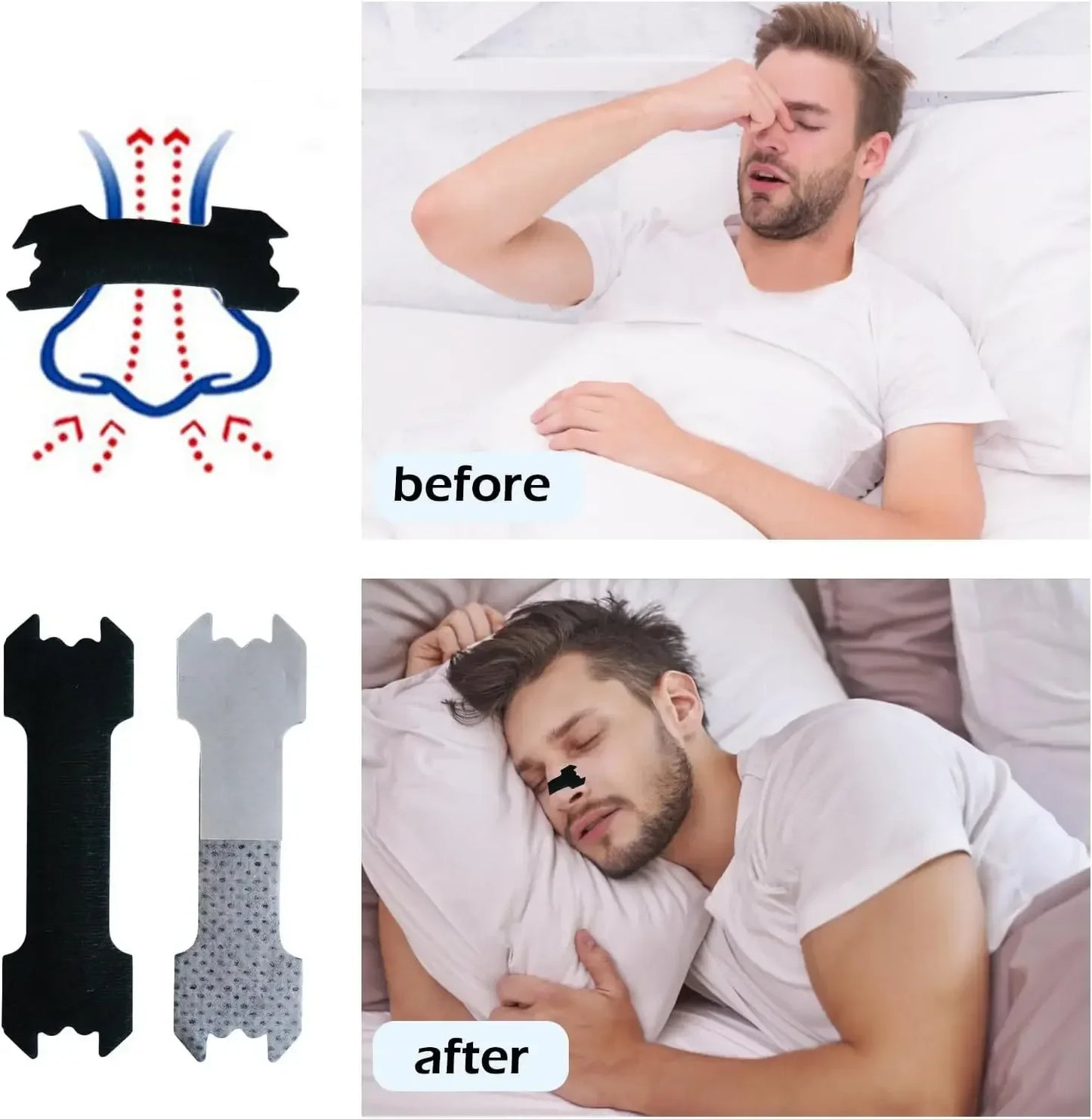 👃Plastry Poszerzające nozdrza👃